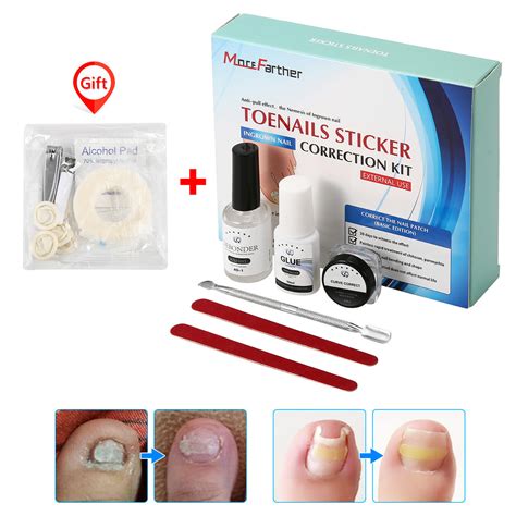 broken toenail repair kit